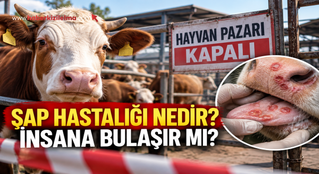 Şap Hastalığı Nedir? İnsana Bulaşır mı?