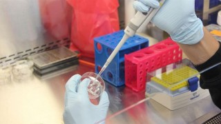 Türkiye, PCR test kiti üretiminde dünya sıralamasında ilk 3'te
